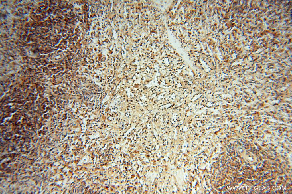 Immunohistochemistry (IHC) staining of human spleen tissue using HSPB8 Polyclonal antibody (15287-1-AP)