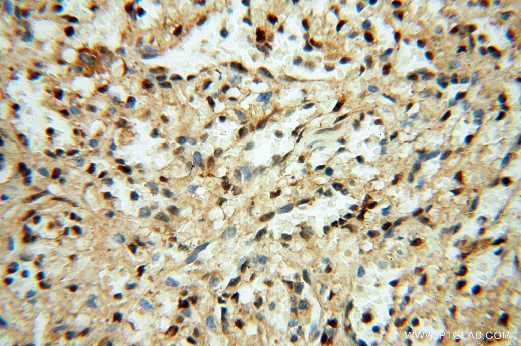 Immunohistochemistry (IHC) staining of human spleen tissue using HSPB8 Polyclonal antibody (15287-1-AP)