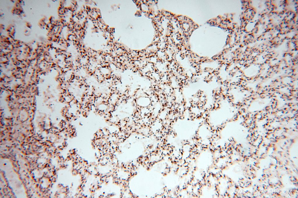 Immunohistochemistry (IHC) staining of human lung tissue using HSPB8 Polyclonal antibody (15287-1-AP)
