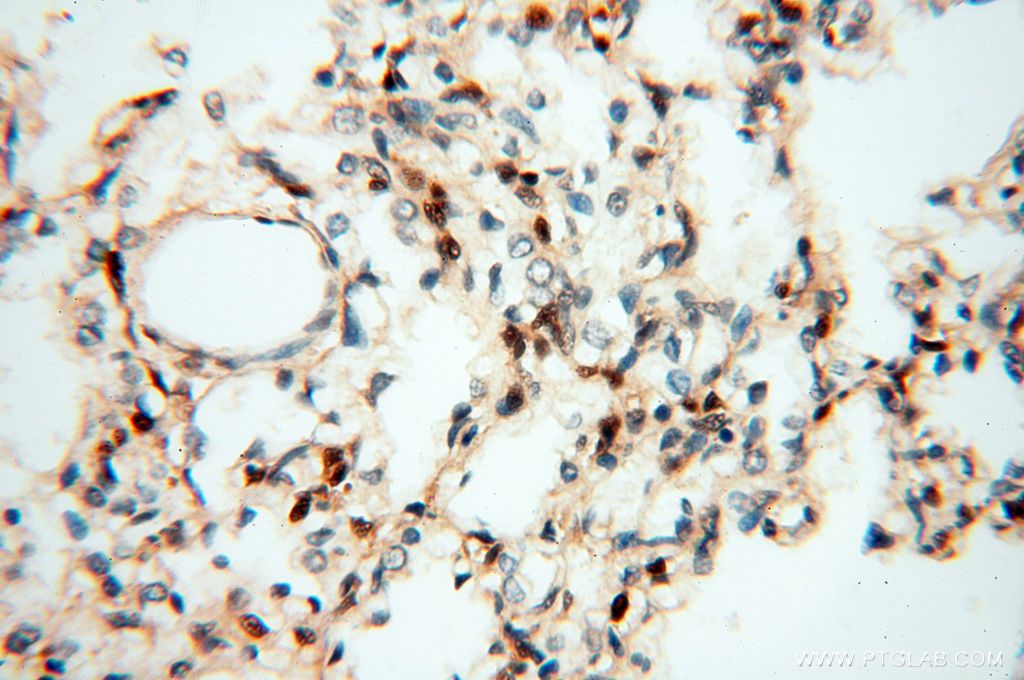 Immunohistochemistry (IHC) staining of human lung tissue using HSPB8 Polyclonal antibody (15287-1-AP)