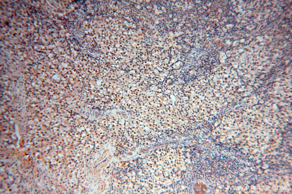 Immunohistochemistry (IHC) staining of human ovary tissue using HSPB8 Polyclonal antibody (15287-1-AP)