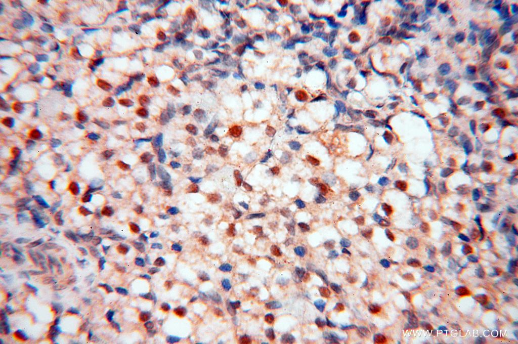 Immunohistochemistry (IHC) staining of human ovary tissue using HSPB8 Polyclonal antibody (15287-1-AP)