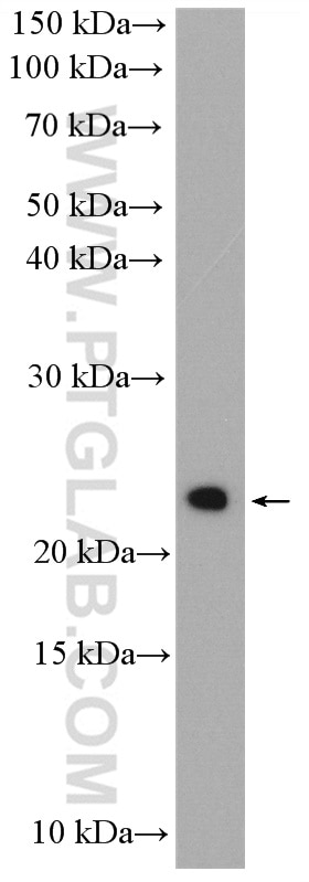 WB analysis of SGC-7901 using 15287-1-AP