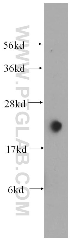 WB analysis of HEK-293 using 15287-1-AP