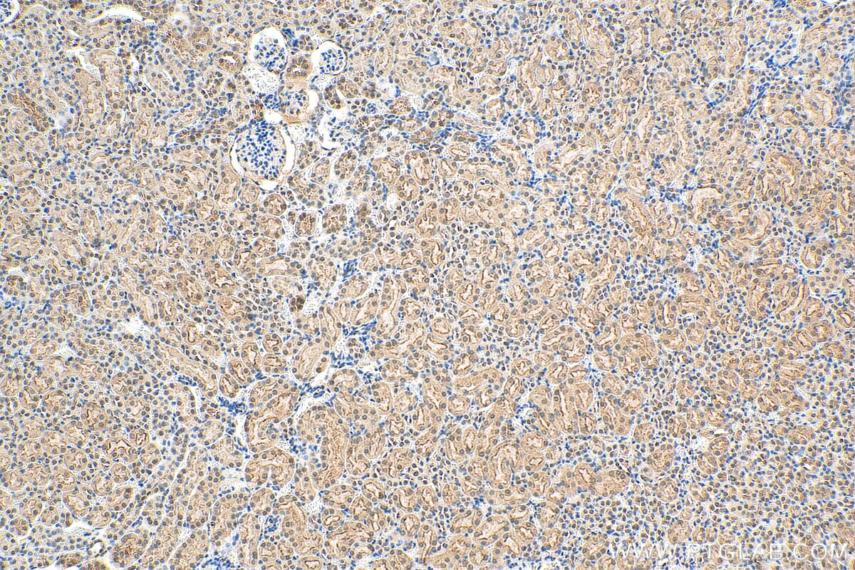 IHC staining of mouse kidney using 27631-1-AP