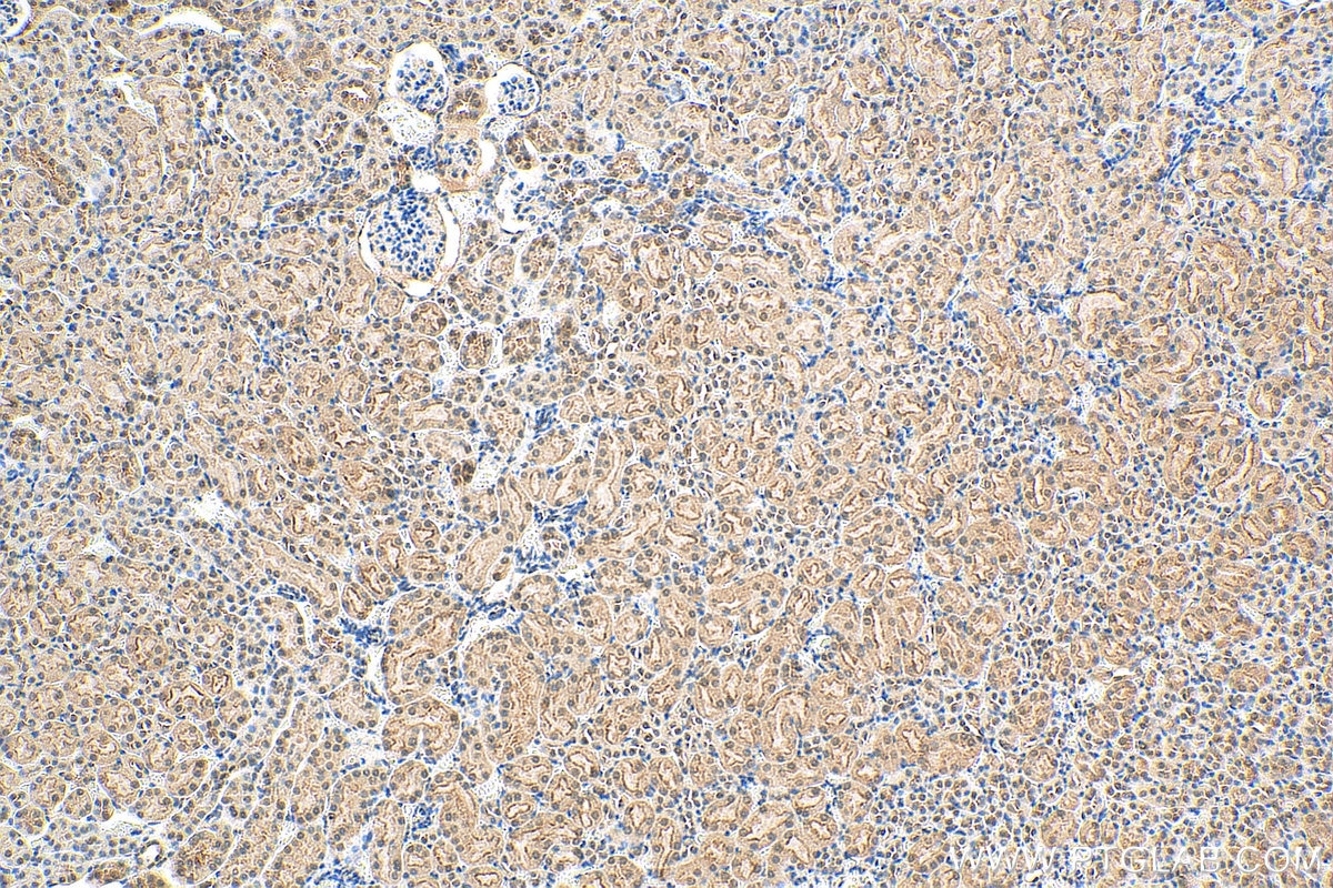 Immunohistochemistry (IHC) staining of mouse kidney tissue using HSPBAP1 Polyclonal antibody (27631-1-AP)