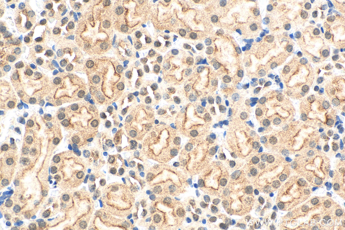 Immunohistochemistry (IHC) staining of mouse kidney tissue using HSPBAP1 Polyclonal antibody (27631-1-AP)