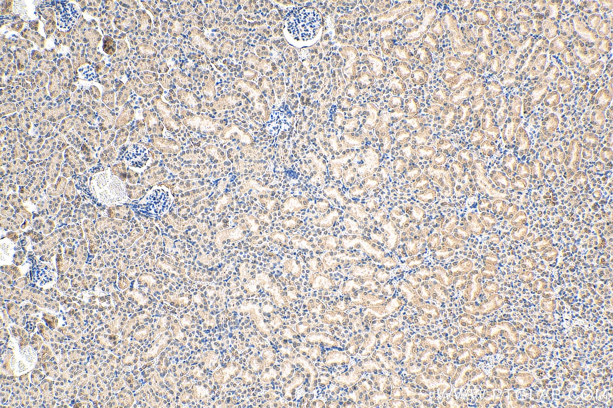 Immunohistochemistry (IHC) staining of mouse kidney tissue using HSPBAP1 Polyclonal antibody (27771-1-AP)