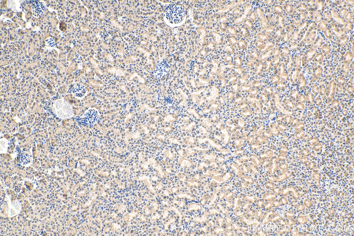 IHC staining of mouse kidney using 27771-1-AP