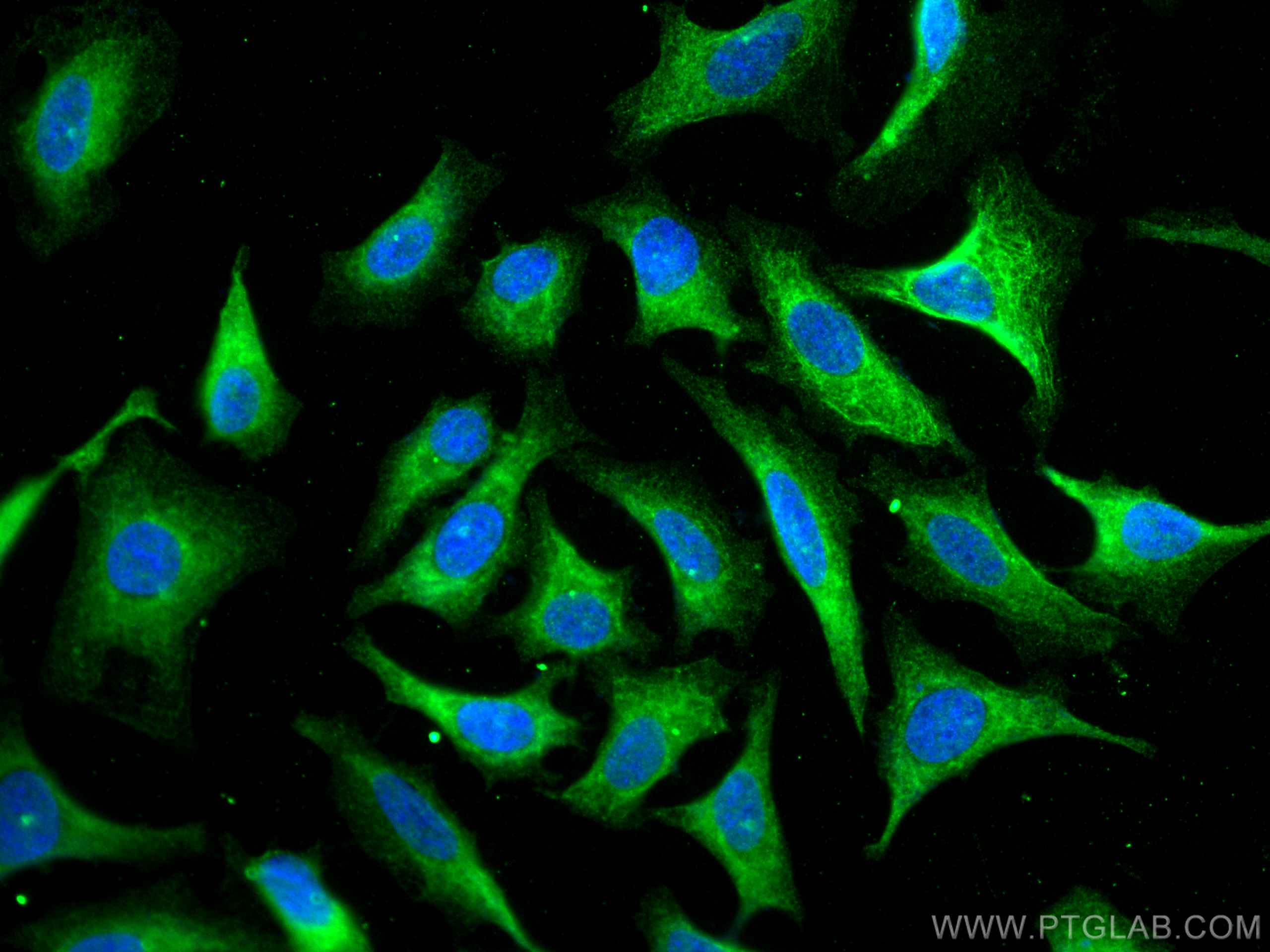 Immunofluorescence (IF) / fluorescent staining of HeLa cells using HSPBP1 Polyclonal antibody (10211-1-AP)