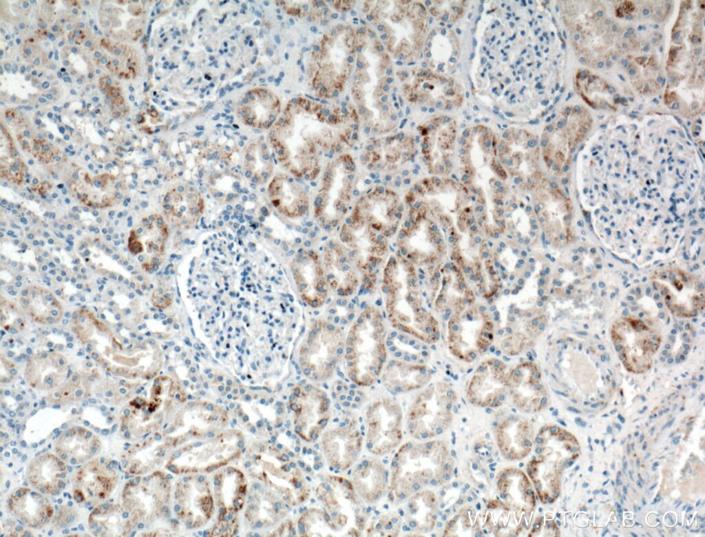 Immunohistochemistry (IHC) staining of human kidney tissue using HSPBP1 Polyclonal antibody (10211-1-AP)