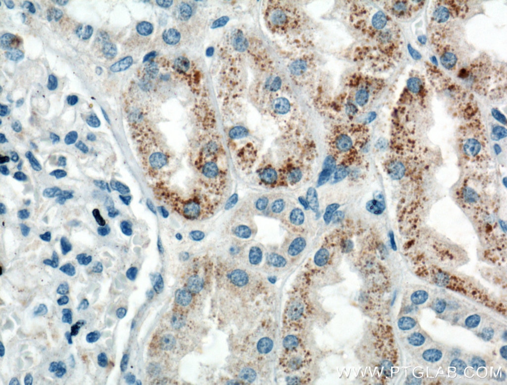 Immunohistochemistry (IHC) staining of human kidney tissue using HSPBP1 Polyclonal antibody (10211-1-AP)
