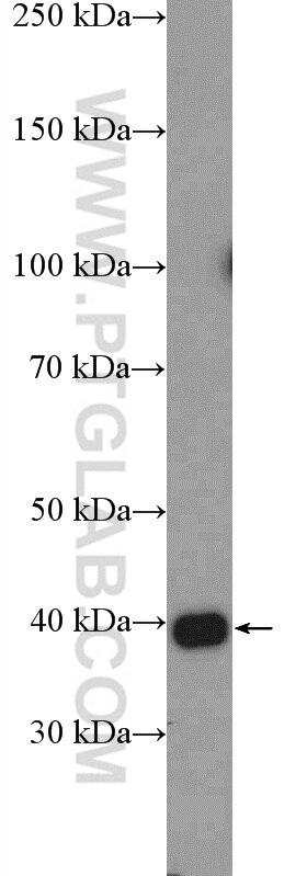 Western Blot (WB) analysis of A549 cells using HSPBP1 Polyclonal antibody (10211-1-AP)