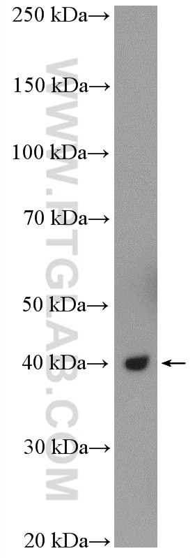 WB analysis of HeLa using 10211-1-AP