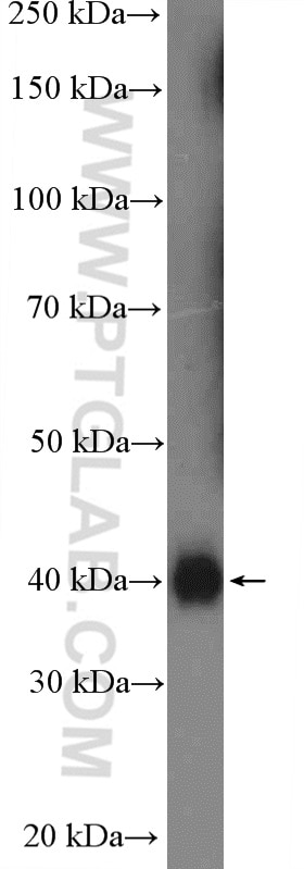 Western Blot (WB) analysis of human skeletal muscle tissue using HSPBP1 Polyclonal antibody (10211-1-AP)