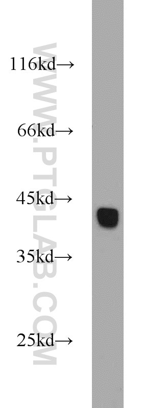 WB analysis of mouse testis using 10211-1-AP