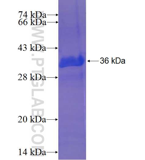 HSPC152 fusion protein Ag24126 SDS-PAGE