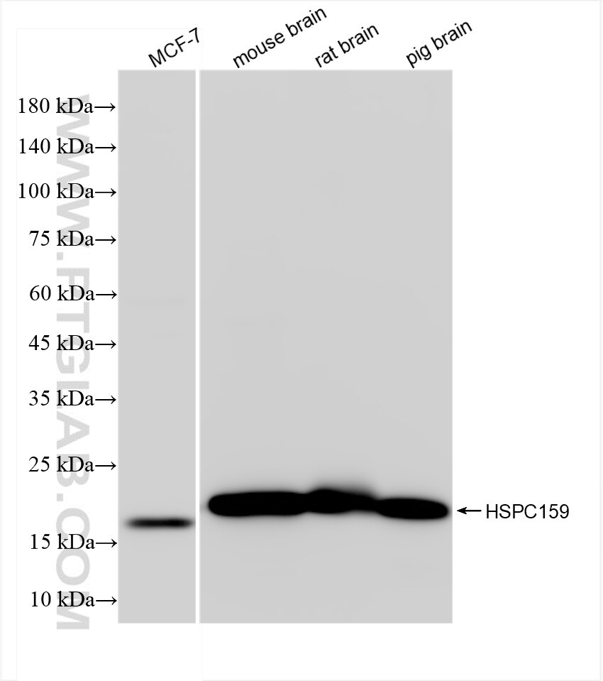 Western Blot (WB) analysis of various lysates using HSPC159 Recombinant antibody (83983-5-RR)