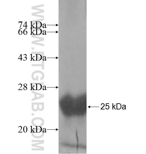 HSPC159 fusion protein Ag9935 SDS-PAGE