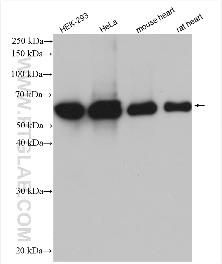 Western Blot (WB) analysis of various lysates using HSP60 Polyclonal antibody (15282-1-AP)