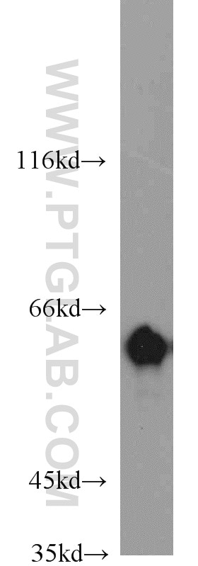 Western Blot (WB) analysis of HepG2 cells using HSP60 Polyclonal antibody (15282-1-AP)