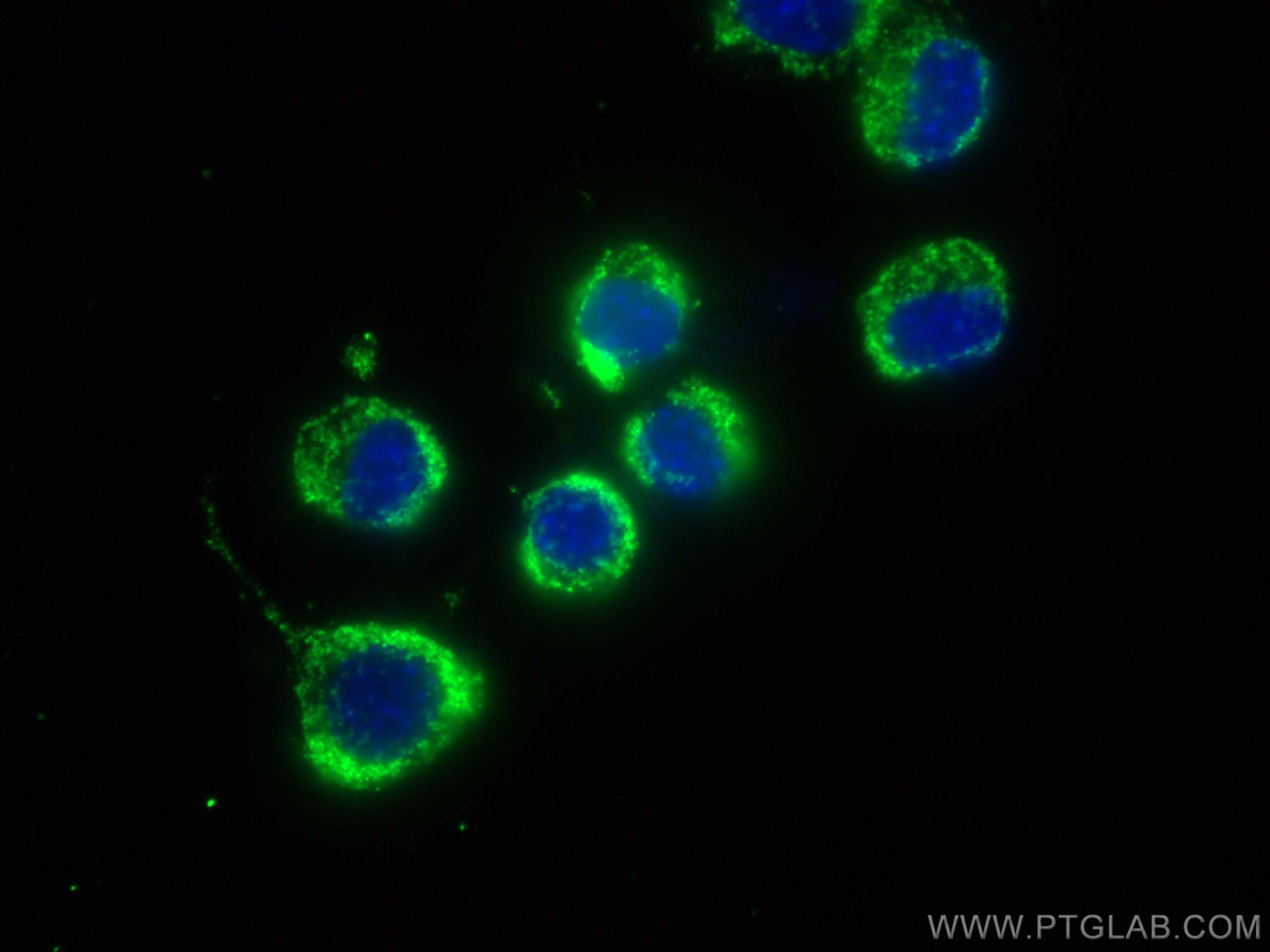 Immunofluorescence (IF) / fluorescent staining of Neuro-2a cells using HSP60 Monoclonal antibody (66041-1-Ig)