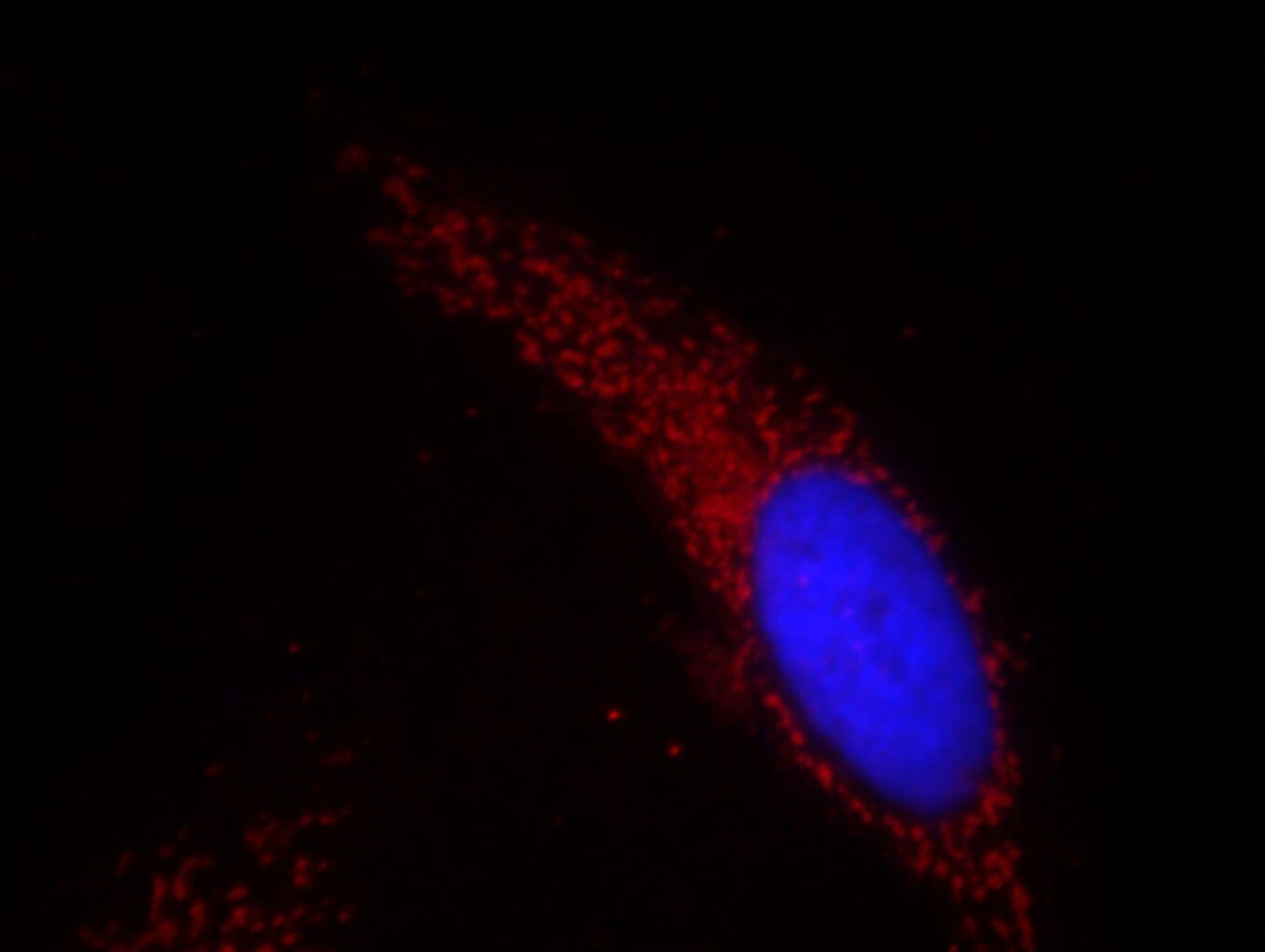 HSP60 Monoclonal antibody