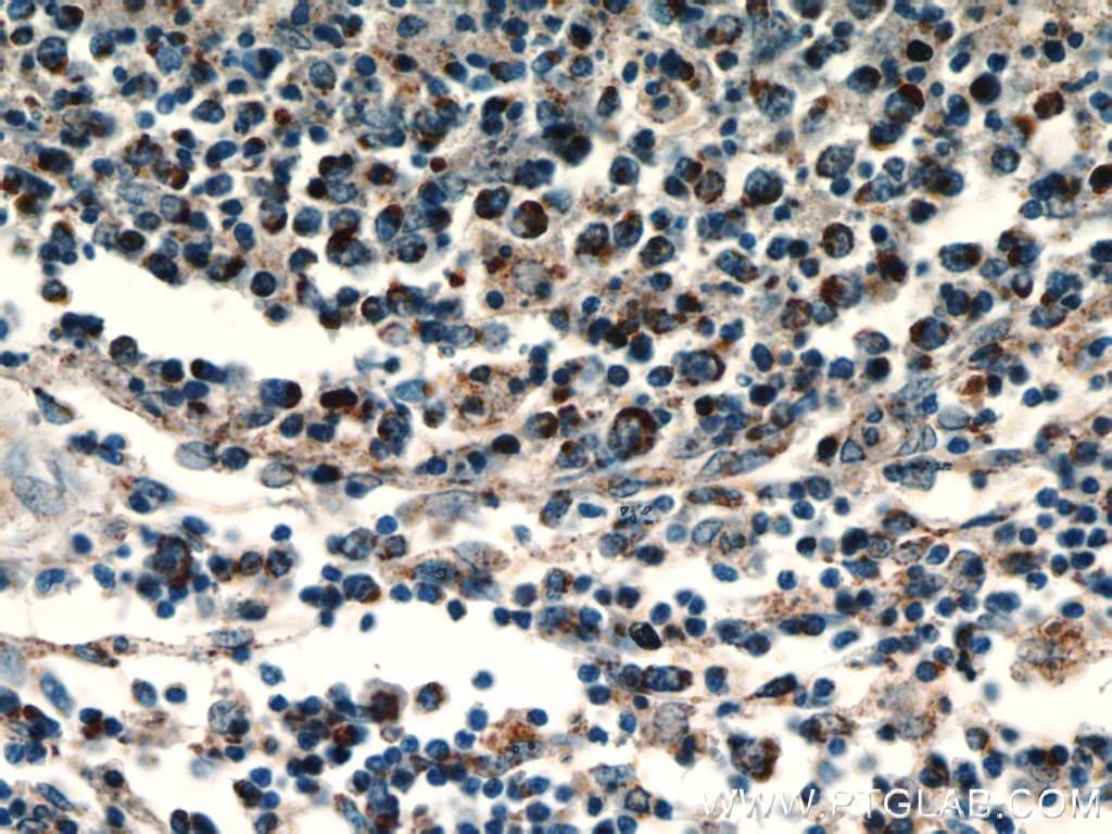 Immunohistochemistry (IHC) staining of human spleen tissue using HSP60 Monoclonal antibody (66041-1-Ig)