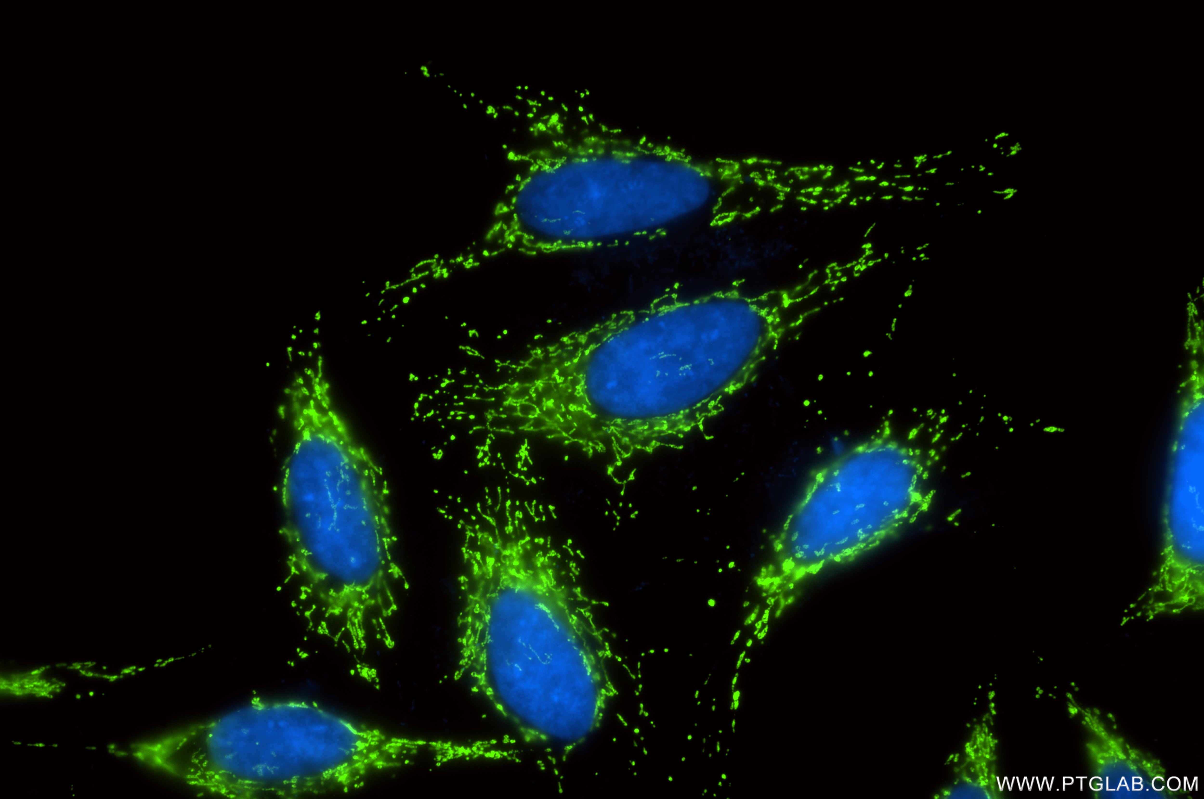 Immunofluorescence (IF) / fluorescent staining of HeLa cells using HSP60 Recombinant monoclonal antibody (86275-1-RR)