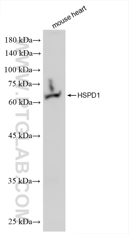 WB analysis of mouse heart using 86275-1-RR Western Blot (WB) analysis of mouse heart tissue using HSP60 Recombinant monoclonal antibody (86275-1-RR)