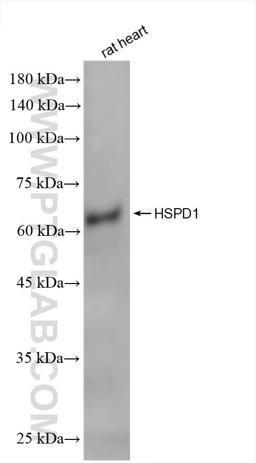 WB analysis of rat heart using 86275-1-RR Western Blot (WB) analysis of rat heart tissue using HSP60 Recombinant monoclonal antibody (86275-1-RR)