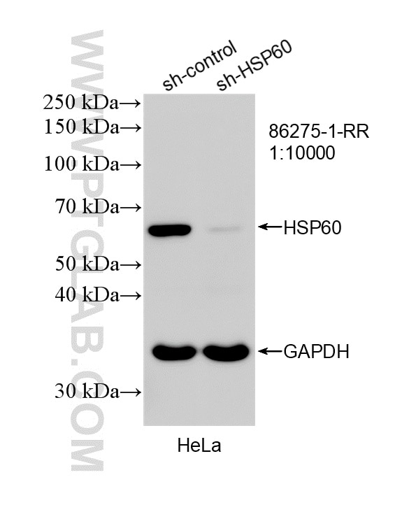 Western Blot (WB) analysis of HeLa cells using HSP60 Recombinant monoclonal antibody (86275-1-RR)