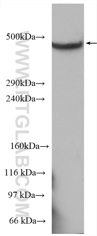 Western Blot (WB) analysis of COLO 320 cells using HSPG2-Specific Polyclonal antibody (19675-1-AP)