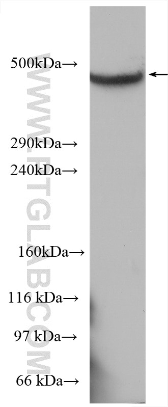 WB analysis of COLO 320 using 19675-1-AP