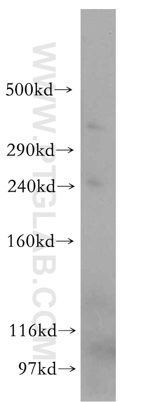 HSPG2-Specific Polyclonal antibody