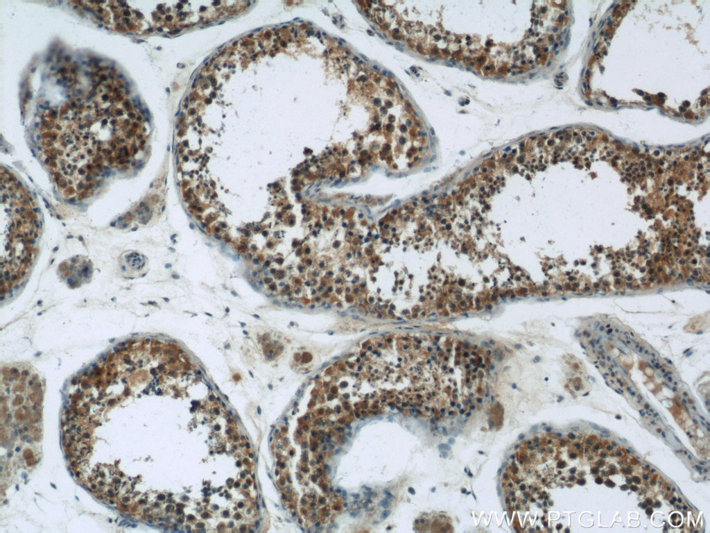Immunohistochemistry (IHC) staining of human testis tissue using HSPH1 Polyclonal antibody (13383-1-AP)