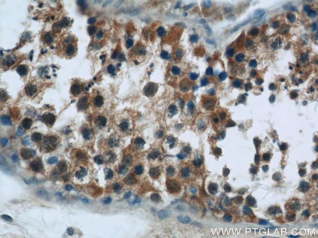 Immunohistochemistry (IHC) staining of human testis tissue using HSPH1 Polyclonal antibody (13383-1-AP)