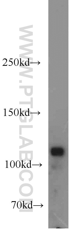 Western Blot (WB) analysis of HeLa cells using HSPH1 Polyclonal antibody (13383-1-AP)