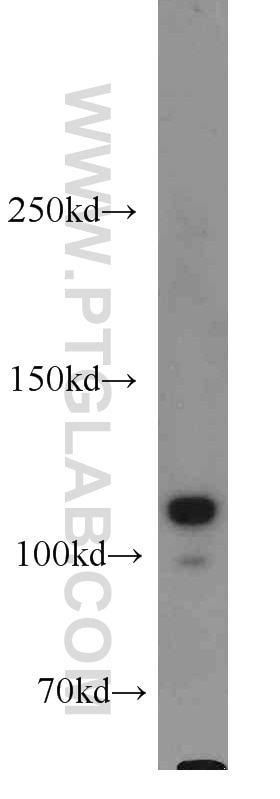 Western Blot (WB) analysis of MCF-7 cells using HSPH1 Polyclonal antibody (13383-1-AP)