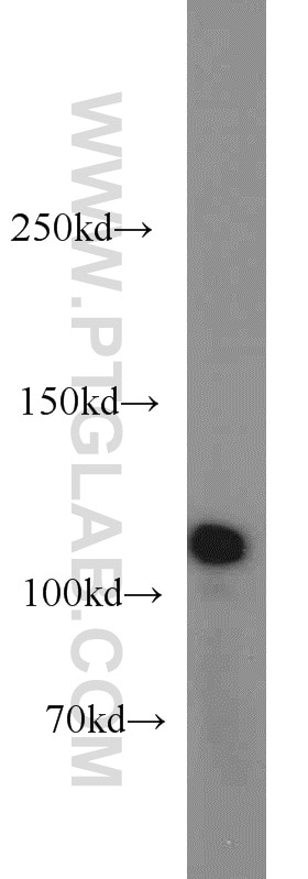 Western Blot (WB) analysis of Jurkat cells using HSPH1 Polyclonal antibody (13383-1-AP)