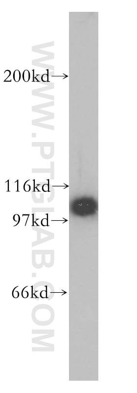 Western Blot (WB) analysis of human brain tissue using HSPH1 Polyclonal antibody (13383-1-AP)