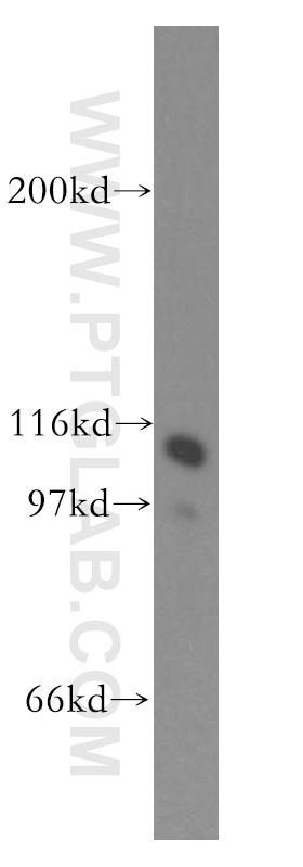 Western Blot (WB) analysis of K-562 cells using HSPH1 Polyclonal antibody (13383-1-AP)