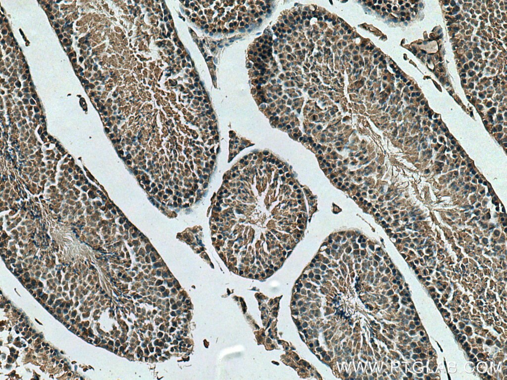 Immunohistochemistry (IHC) staining of mouse testis tissue using HSPH1 Monoclonal antibody (66723-1-Ig)