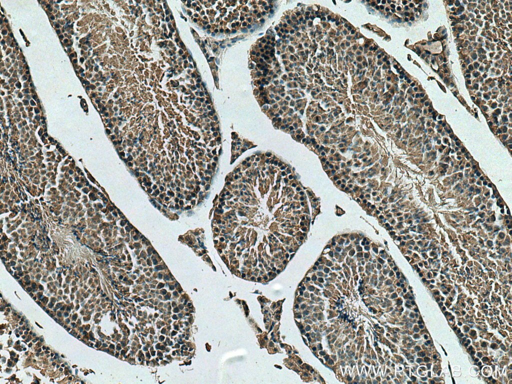 IHC staining of mouse testis using 66723-1-Ig