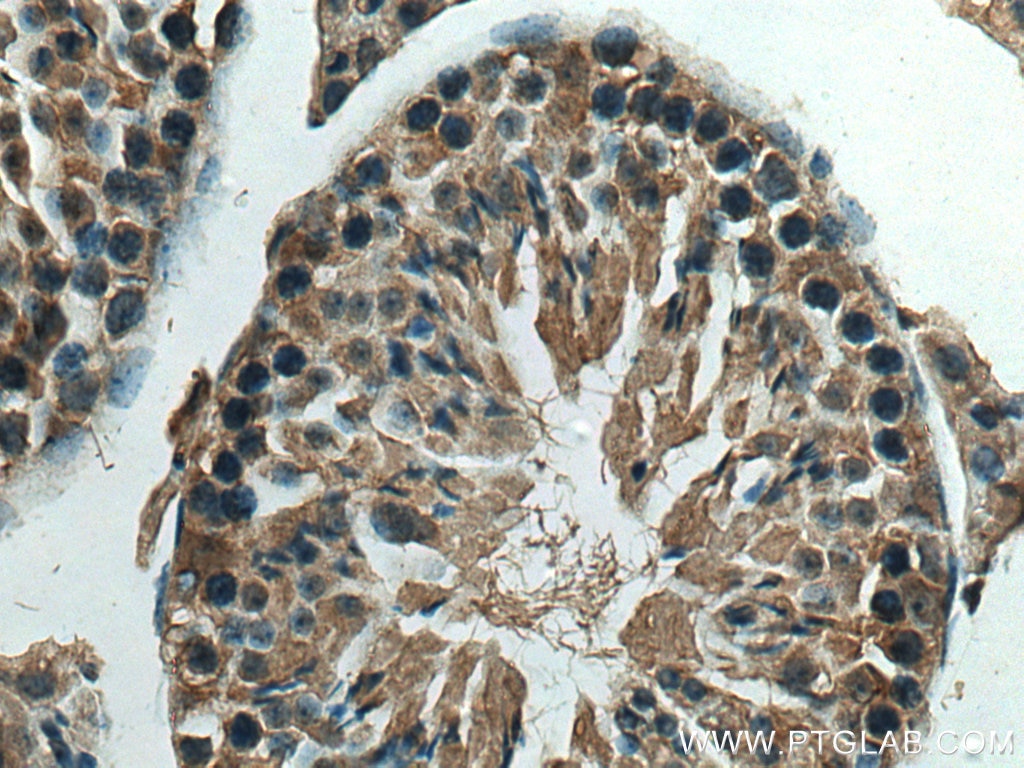 Immunohistochemistry (IHC) staining of mouse testis tissue using HSPH1 Monoclonal antibody (66723-1-Ig)