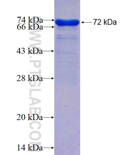 HSPH1 fusion protein Ag4224 SDS-PAGE