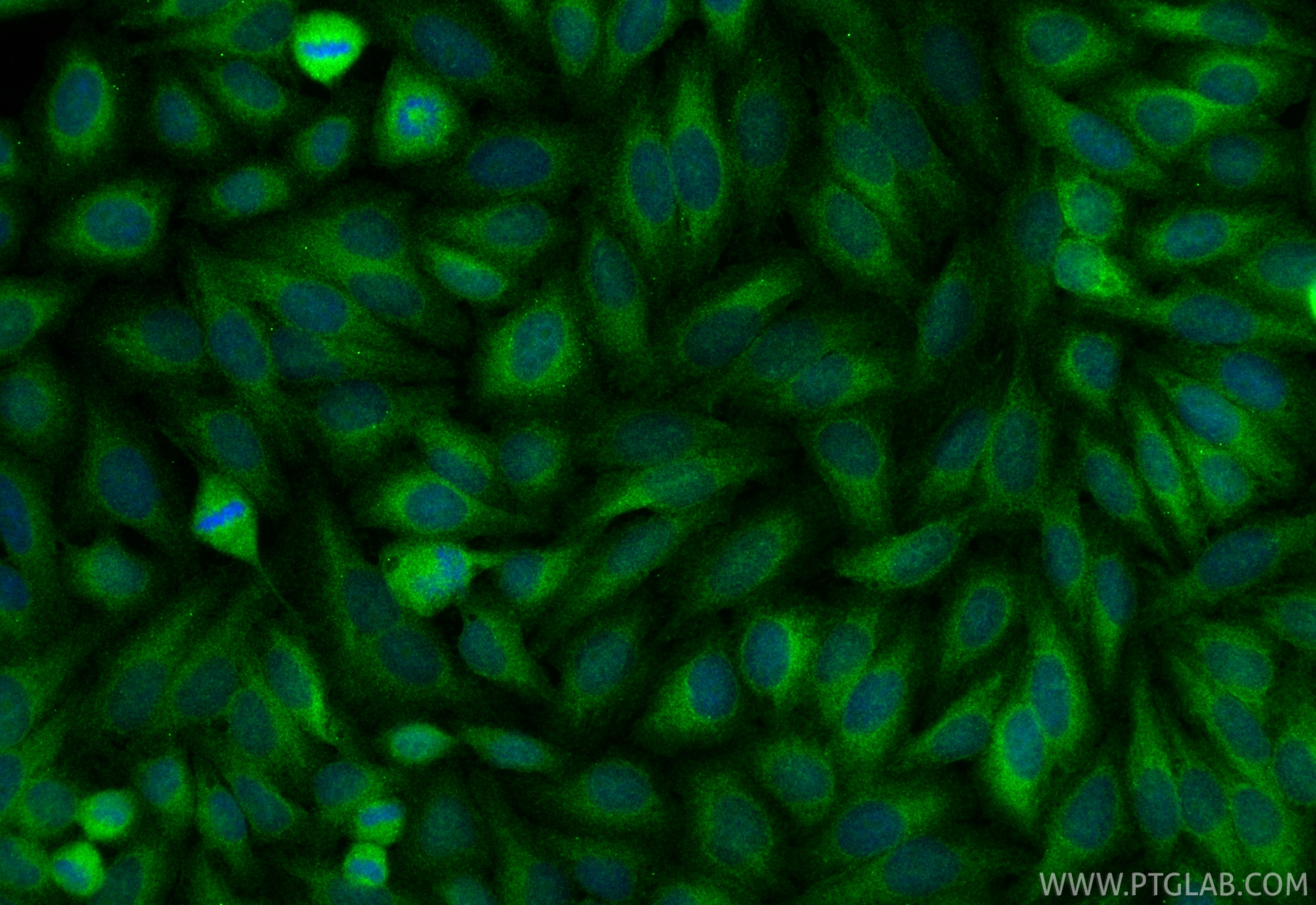Immunofluorescence (IF) / fluorescent staining of HepG2 cells using TIP30 Polyclonal antibody (10251-1-AP)