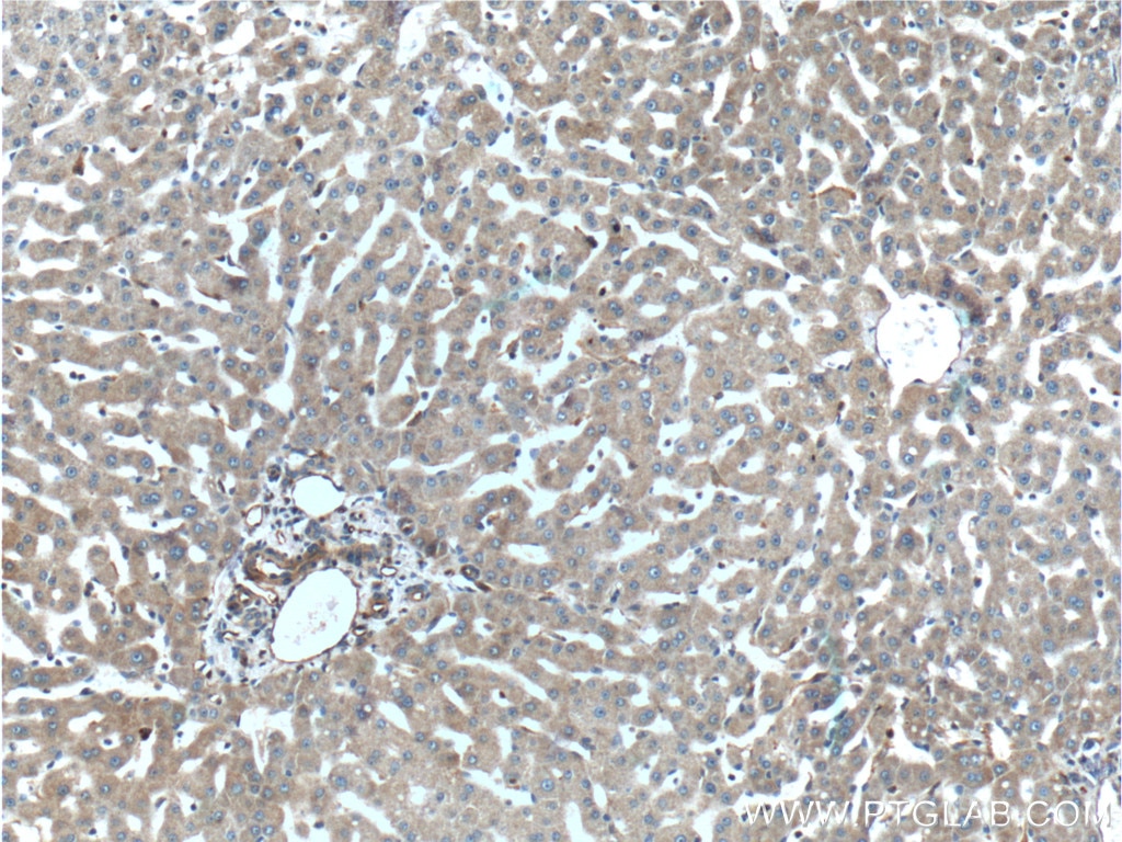 Immunohistochemistry (IHC) staining of human liver tissue using TIP30 Polyclonal antibody (10251-1-AP)