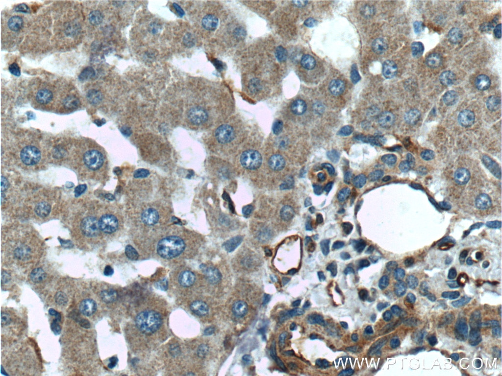 Immunohistochemistry (IHC) staining of human liver tissue using TIP30 Polyclonal antibody (10251-1-AP)