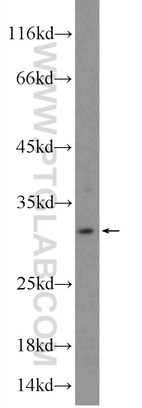 Western Blot (WB) analysis of HeLa cells using TIP30 Polyclonal antibody (10251-1-AP)